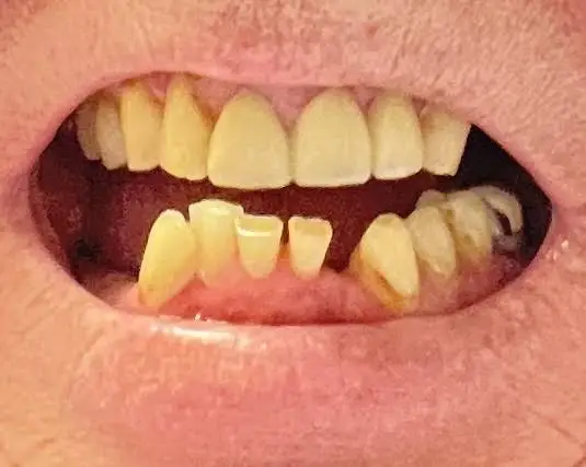 Fallston Family Dentistry
