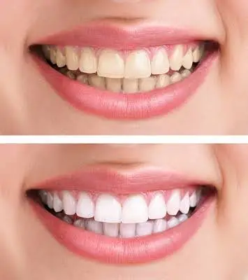 Chesapeake Contemporary Dentistry