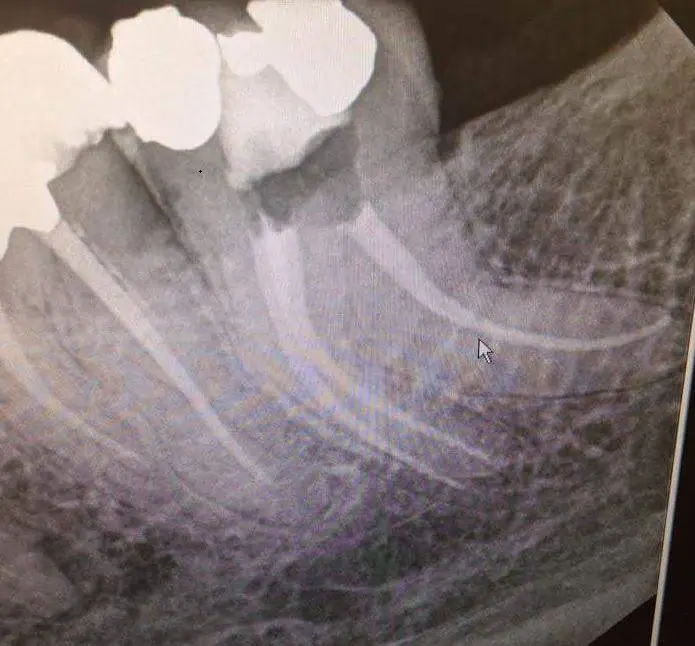 Endodontic Partners