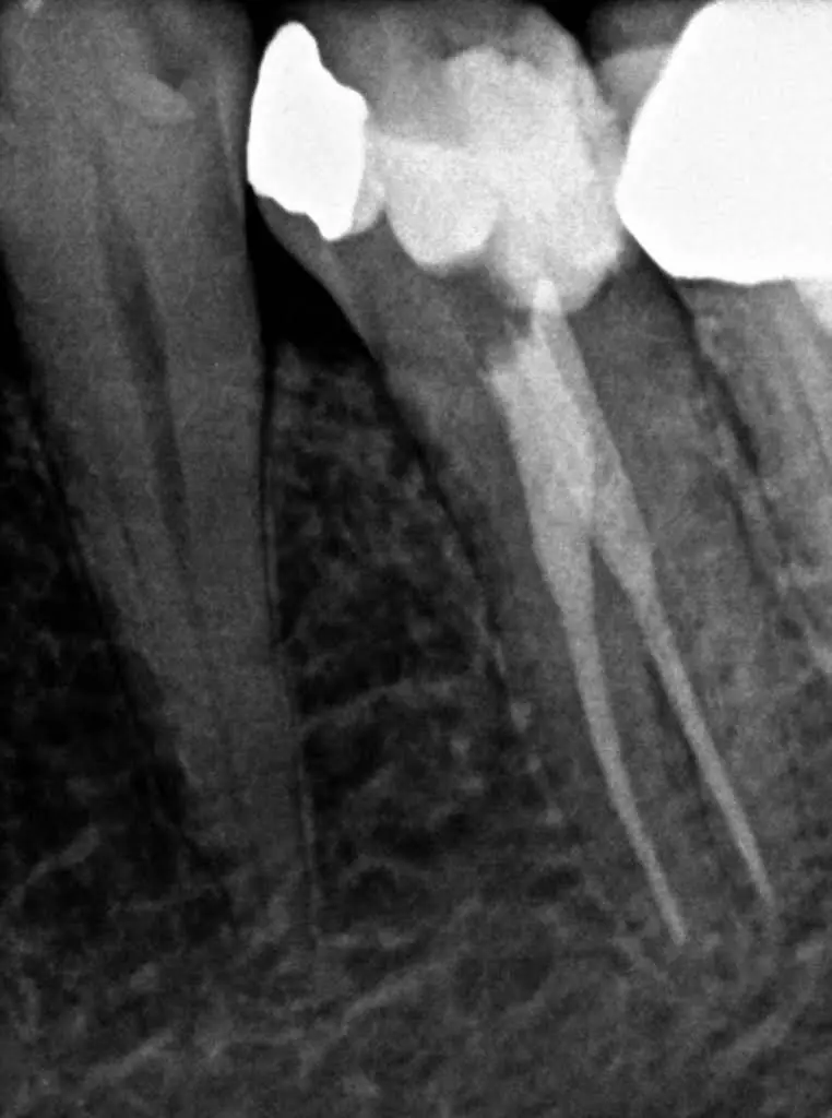 Endodontic Partners