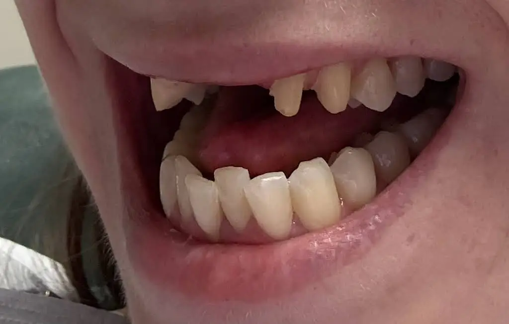 Dental One Associates of Westminster