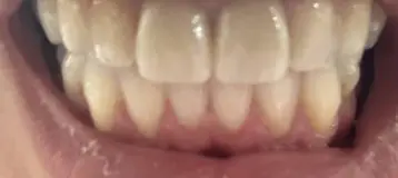 Precision Dental of Westminster