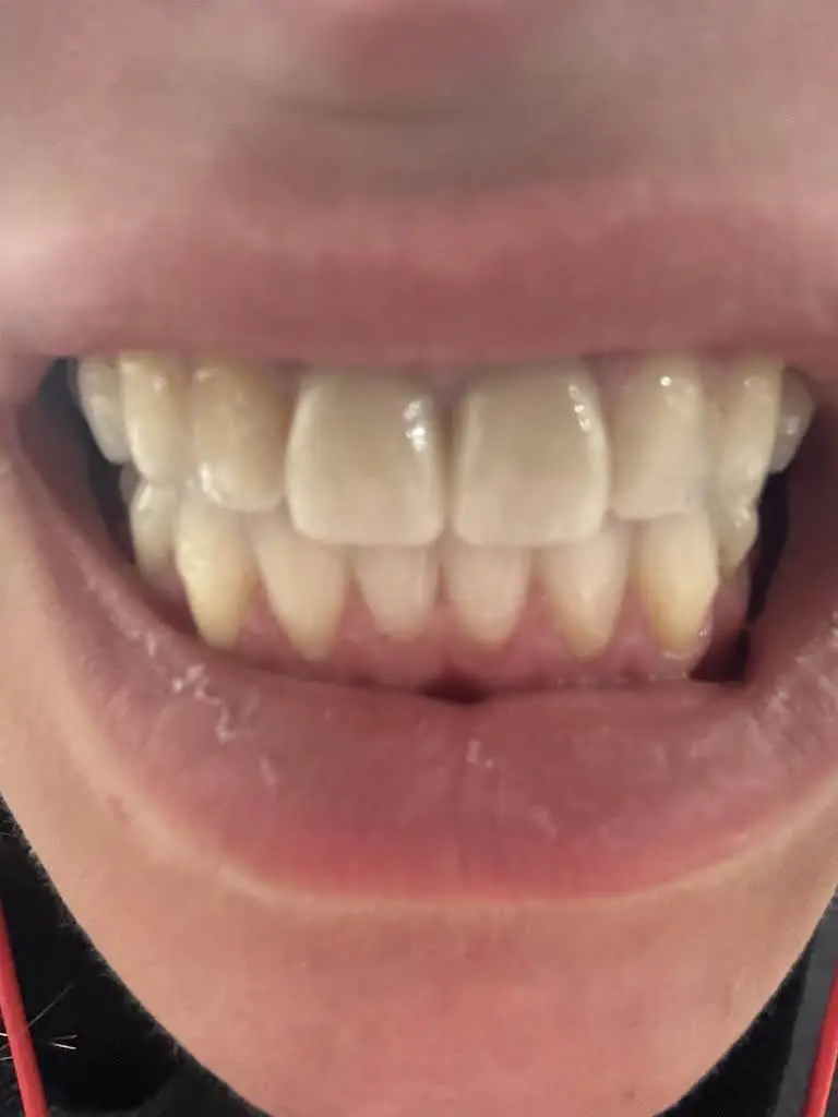 Precision Dental of Westminster