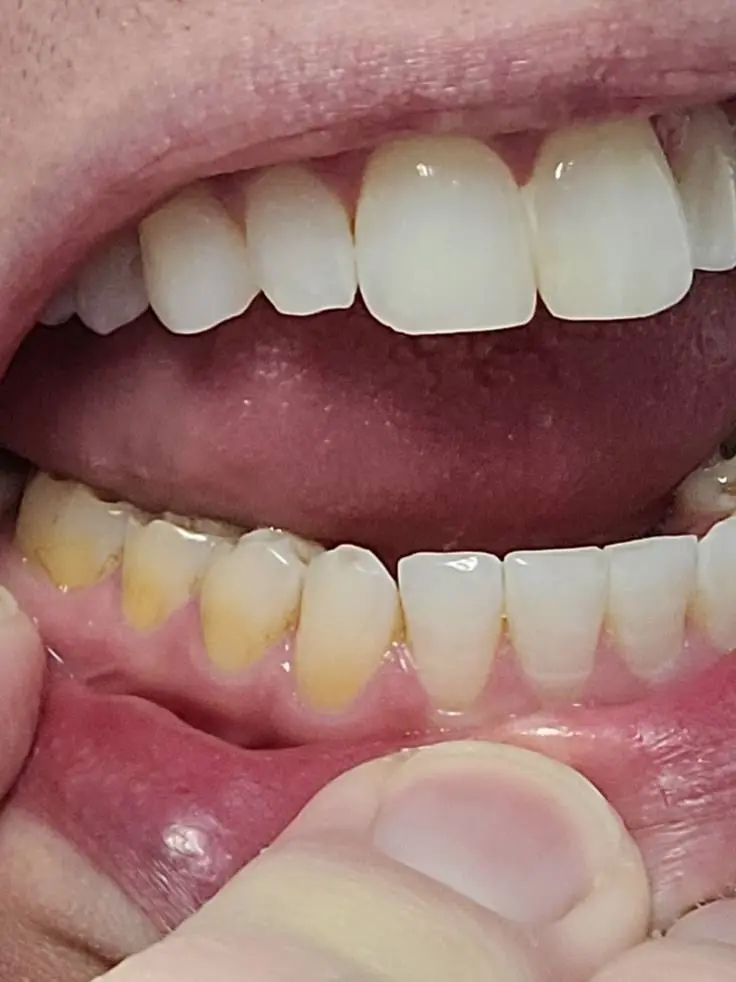 Valley Dental Health