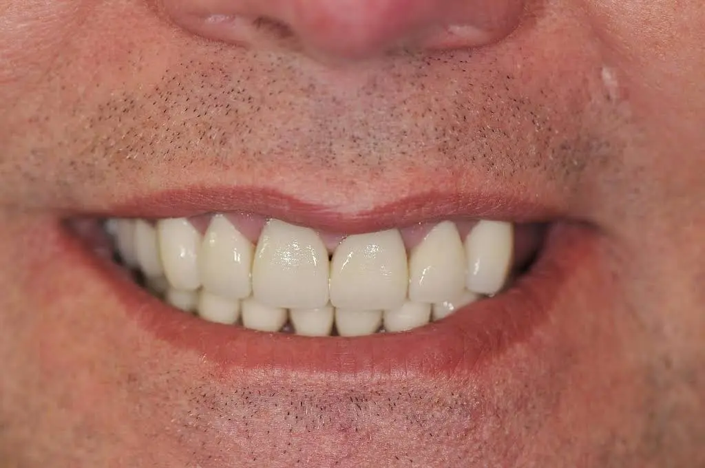 My Ashburn Dentist