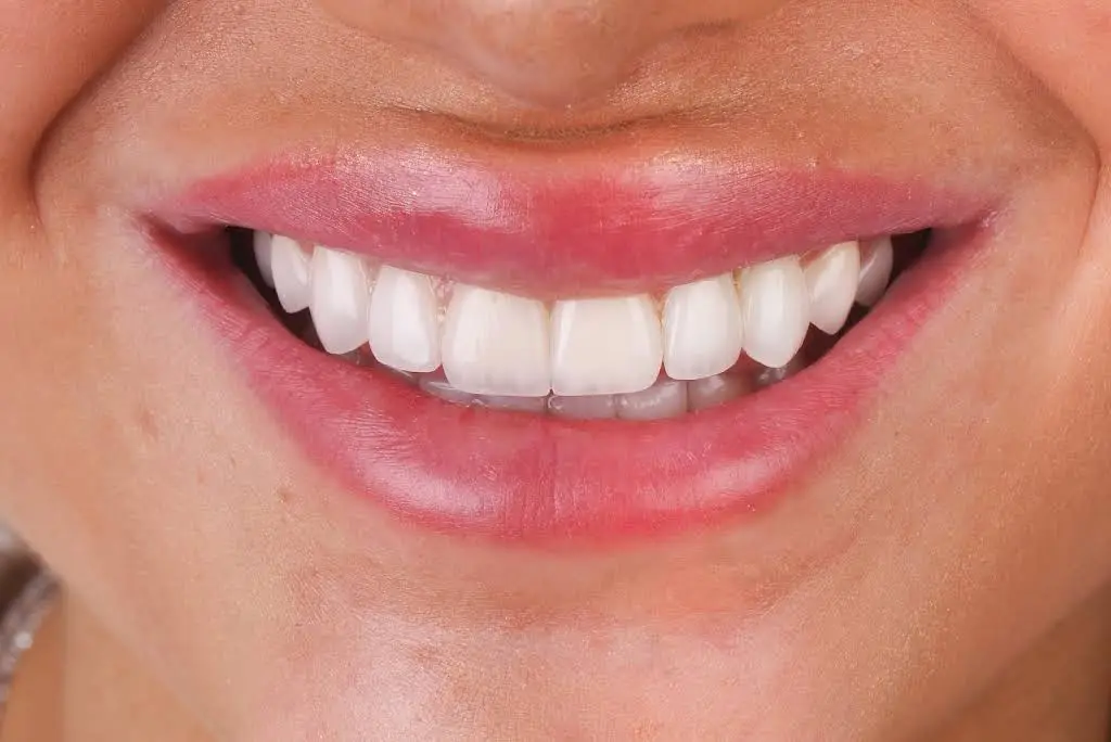 My Ashburn Dentist
