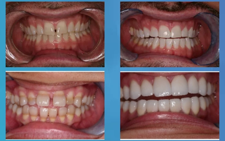 Modern Touch Dentistry