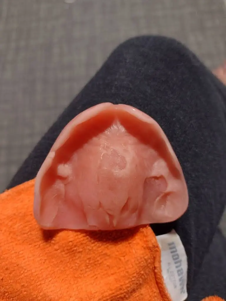 Affordable Dentures & Implants