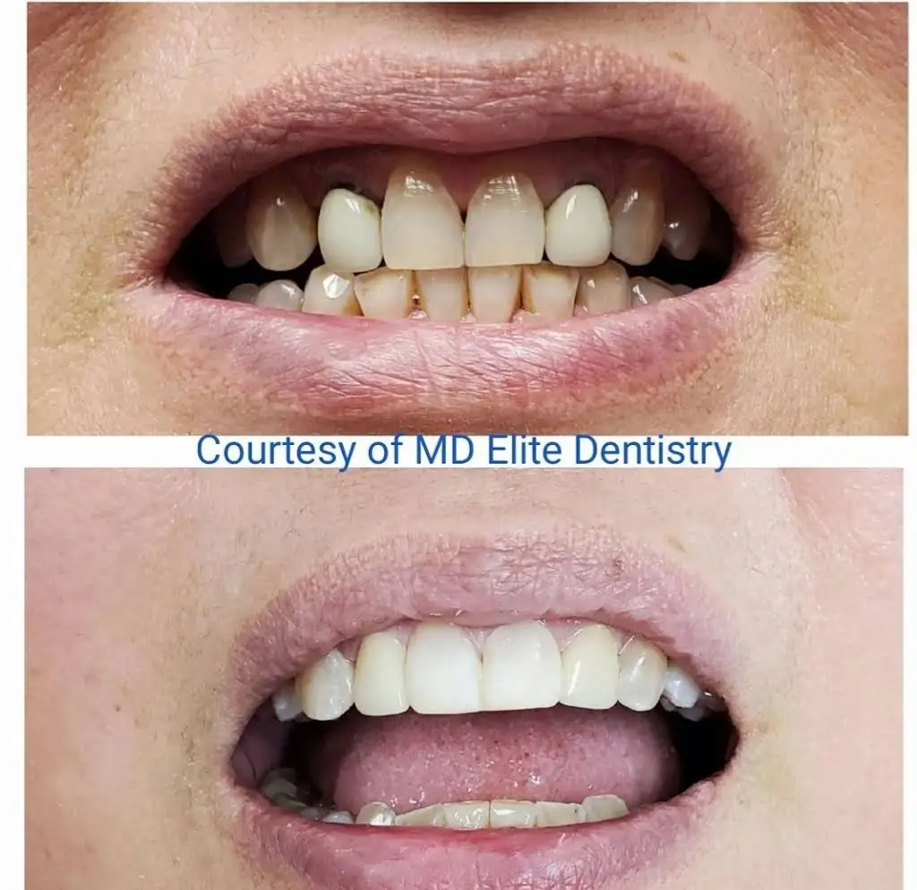Maryland Elite Dentistry
