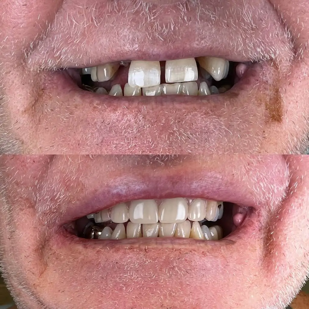 Dental 32 Fresh Smiles
