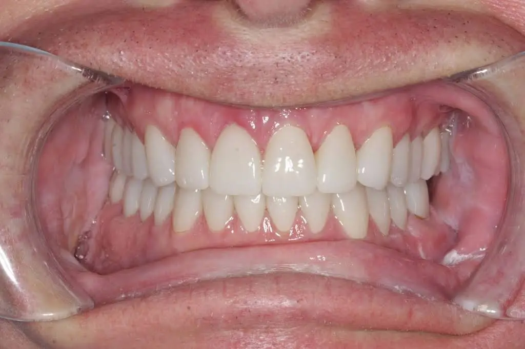 Precision Dentistry of Howard
