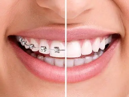 Noorani Orthodontics