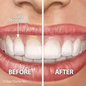 Carroll Family Dentistry / Dr. WANG DDS's Office
