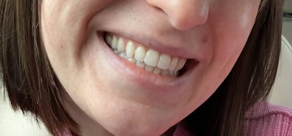 Old Dominion Orthodontics