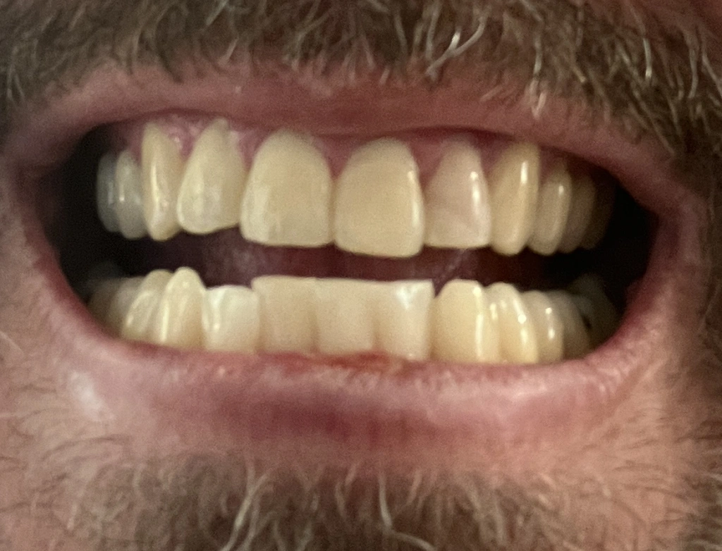 Scheske Family Dental