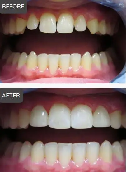 Clearly Dental