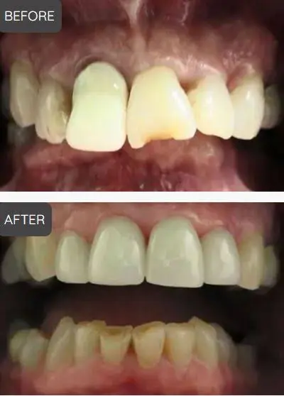 Clearly Dental