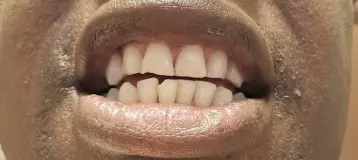 Aberdeen Dental Care