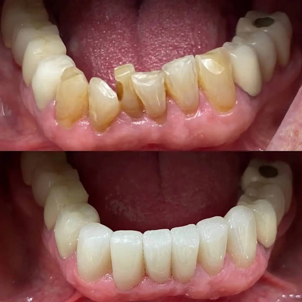 Avin Dental Care