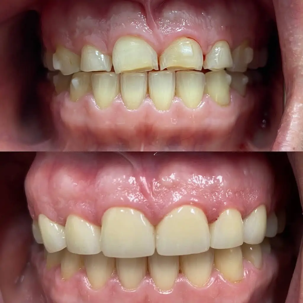 Avin Dental Care