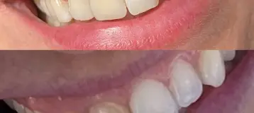 LaCanne Family Dental