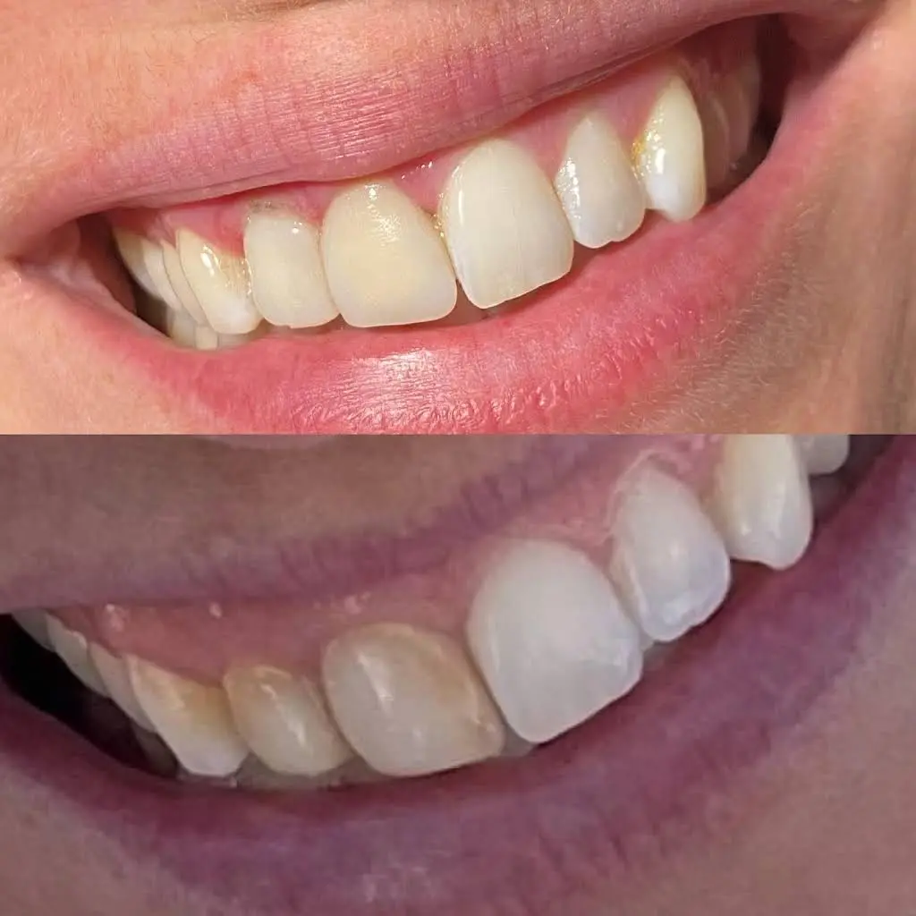 LaCanne Family Dental