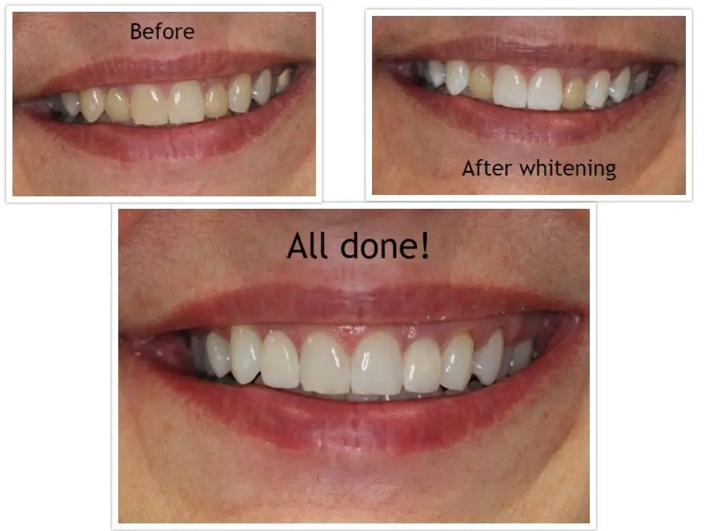 LaCanne Family Dental