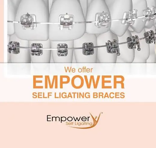 Orthodontic Specialists of Green Bay