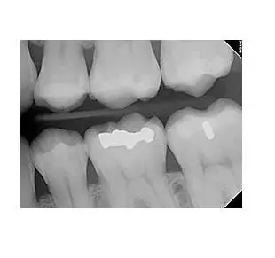 Orthodontic Specialists of Green Bay