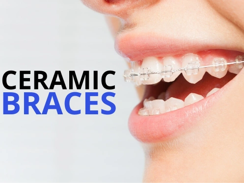 Wilke Orthodontics