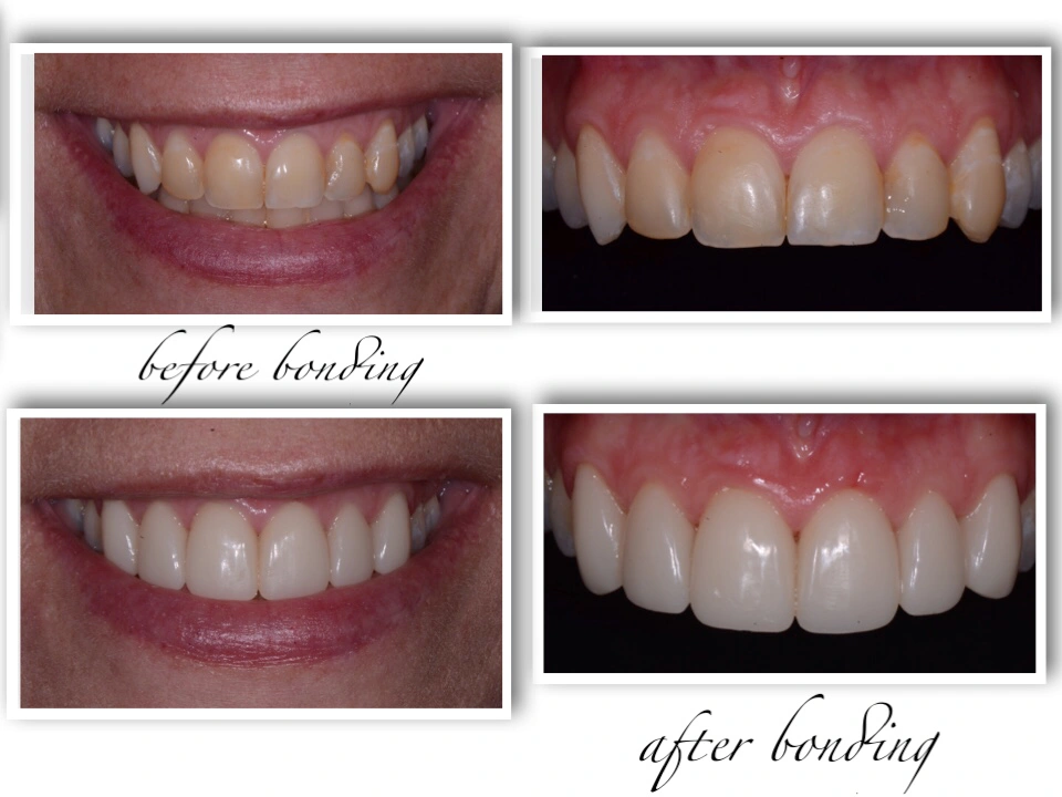 Cherrywood Dental - Savage