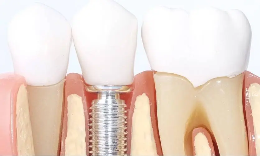 Echo Family Dental