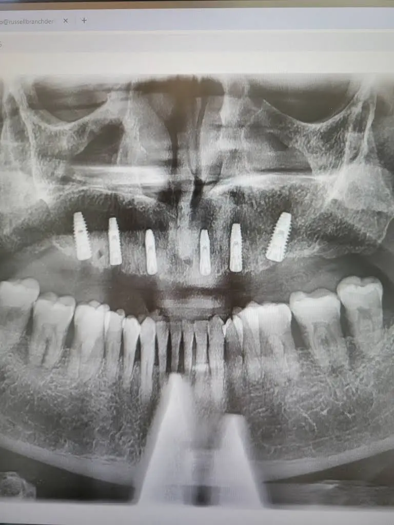 Russell Branch Dental & Orthodontics