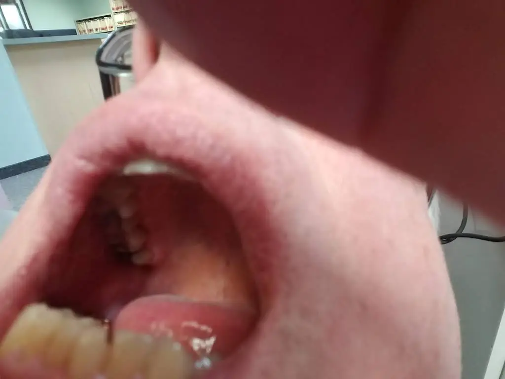 Burnsville Family Dental