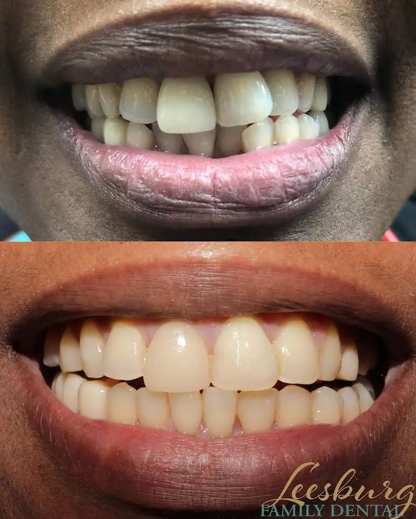 Leesburg Family Dental