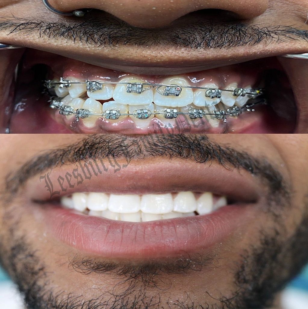 Leesburg Family Dental