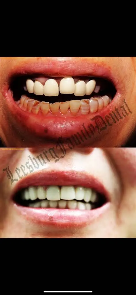 Leesburg Family Dental