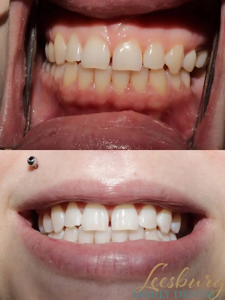 Leesburg Family Dental