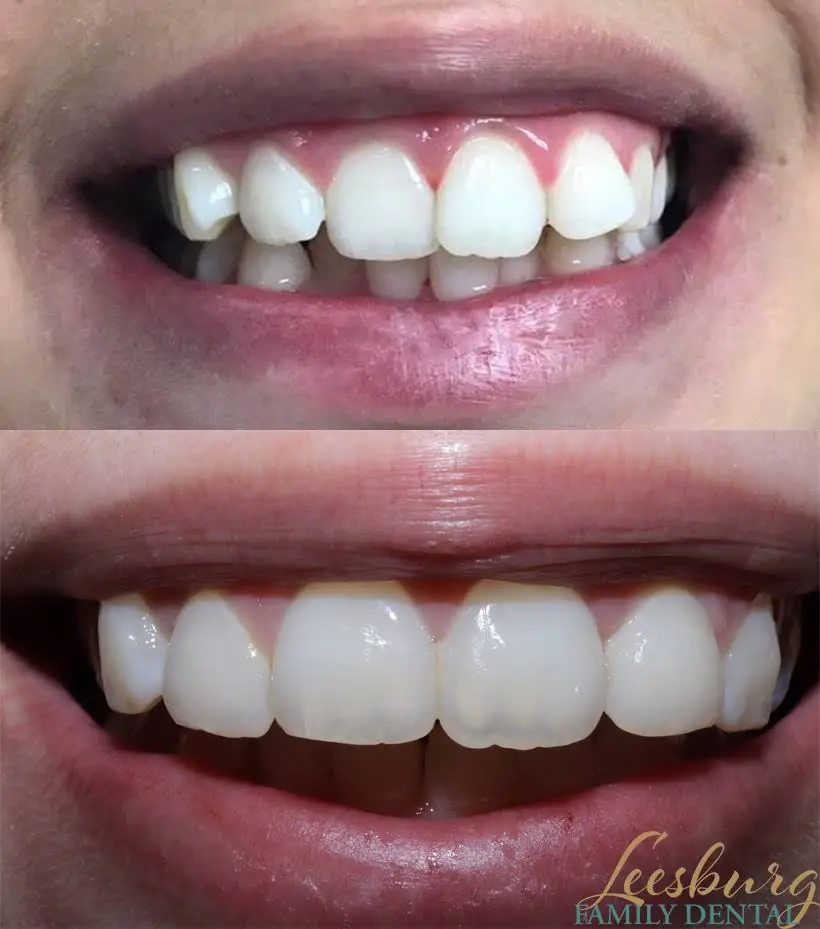 Leesburg Family Dental