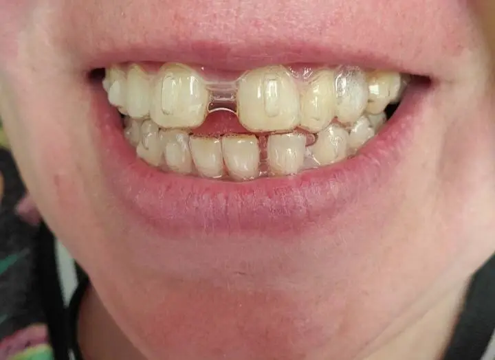 JT Dental