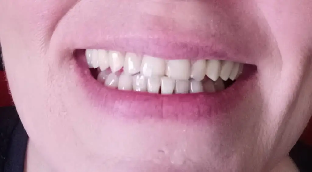 JT Dental