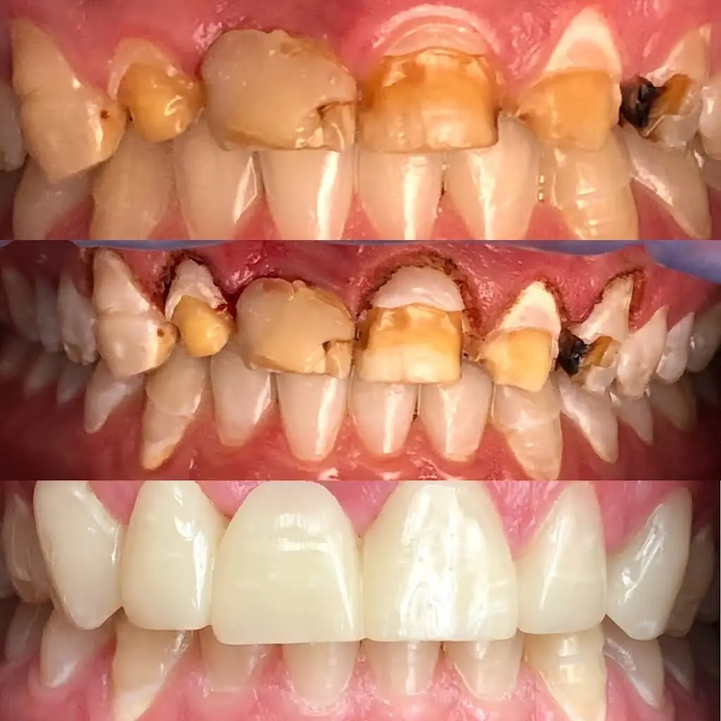 Dental Excellence of Deephaven