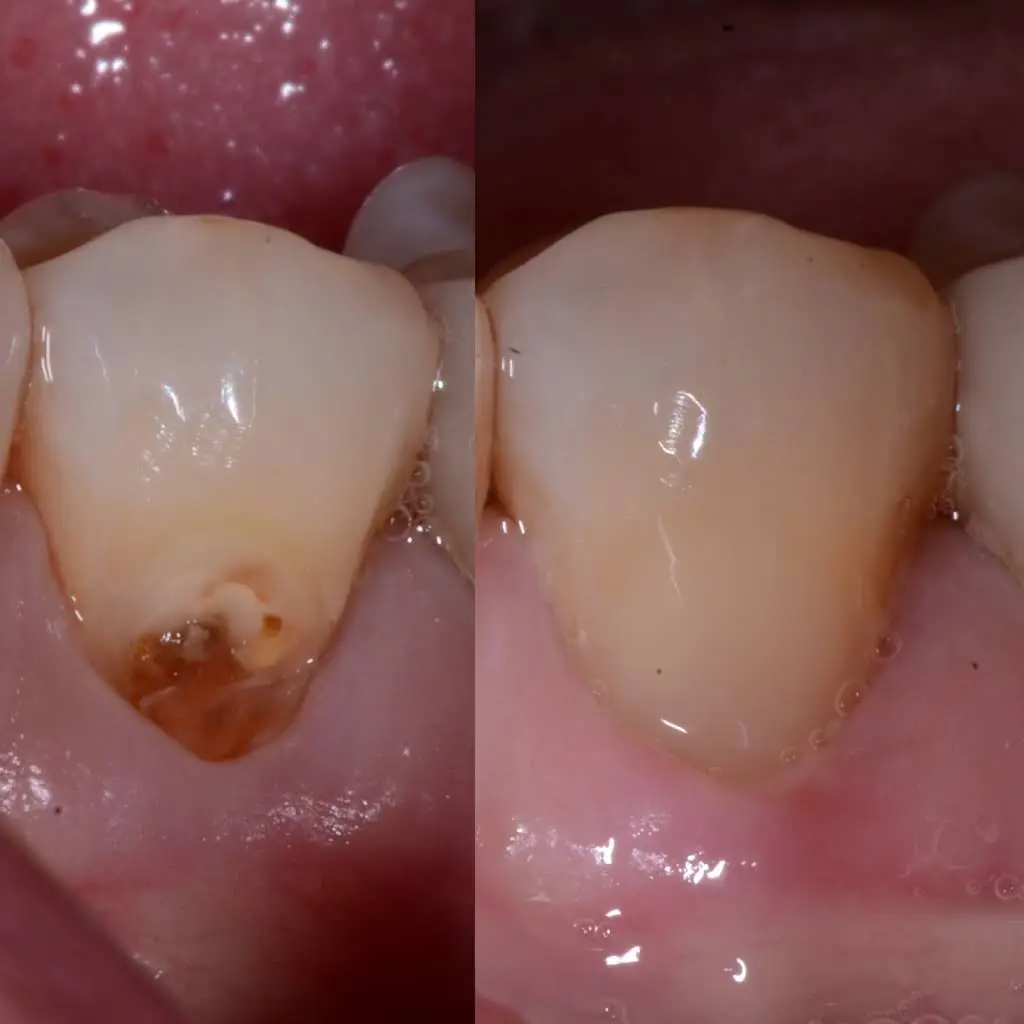 Smile Eden Prairie by Sara Fam DDS