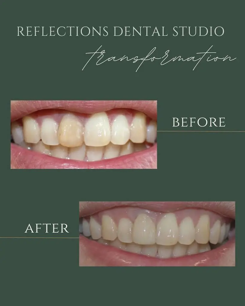 Reflections Dental Studio