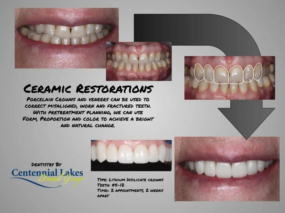 Centennial Lakes Dental Group