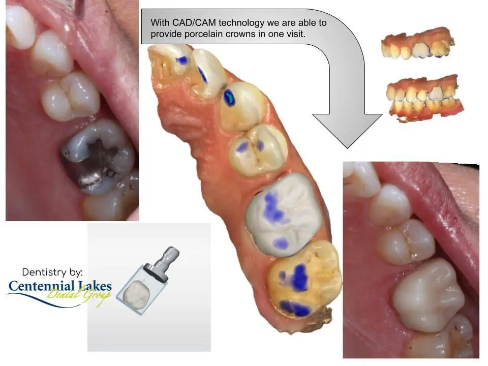 Centennial Lakes Dental Group
