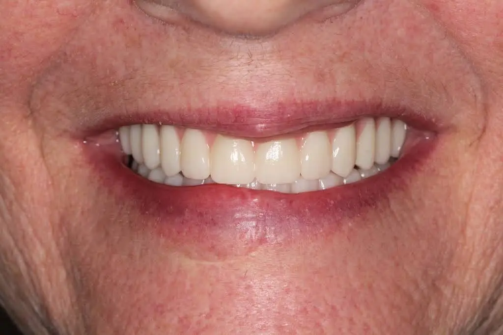 ClearChoice Dental Implant Center