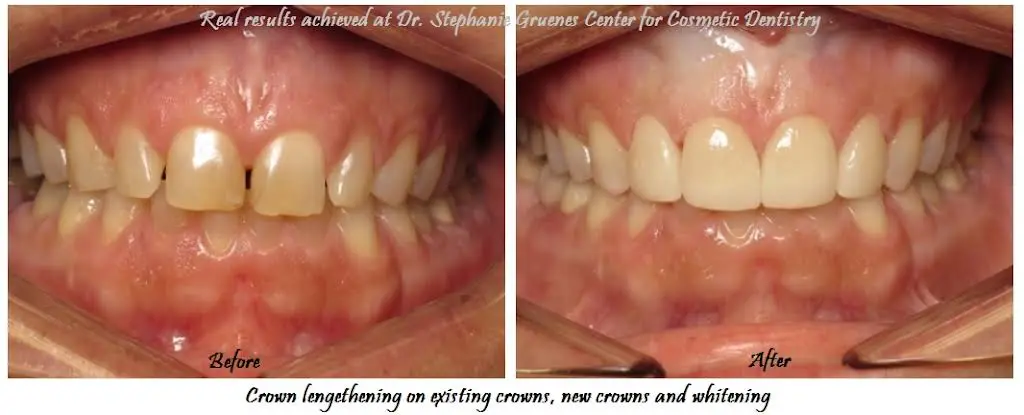 Dr. Stephanie Gruenes - Center For Cosmetic Dentistry
