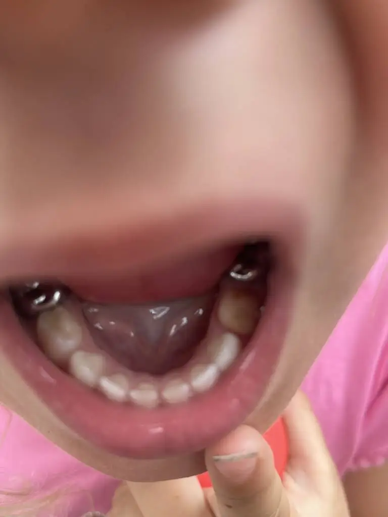 Eagan Children Dentistry