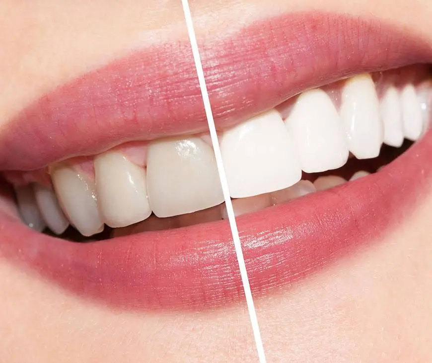 Fifth Ave Dental